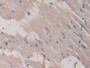DAB staining on IHC-P; Samples: Rat Heart Tissue; Primary Ab: 30ug/ml Mouse Anti-Rat PPARg Antibody Second Ab: 2ug/mL HRP-Linked Caprine Anti-Mouse IgG Polyclonal Antibody