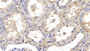 DAB staining on IHC-P; Samples: Porcine Kidney Tissue; Primary Ab: 40ug/ml Mouse Anti-Human ALT Antibody; Second Ab: 2ug/mL HRP-Linked Caprine Anti-Mouse IgG Polyclonal Antibody