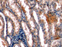 DAB staining on IHC-P; Samples: Human Kidney Tissue; Primary Ab: 10ug/ml Mouse Anti-Human STC1 Antibody Second Ab: 2ug/mL HRP-Linked Caprine Anti-Mouse IgG Polyclonal Antibody