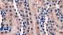 DAB staining on IHC-P; Sample: Rat Kidney Tissue; Primary Ab: 20ug/ml Mouse Anti-Rat FGF15 Antibody Second Ab: 2ug/mL HRP-Linked Caprine Anti-Mouse IgG Polyclonal Antibody