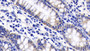 DAB staining on IHC-P; Sample: Human Colon Tissue; Primary Ab: 20ug/ml Mouse Anti-Human CASP9 Antibody Second Ab: 2ug/mL HRP-Linked Caprine Anti-Mouse IgG Polyclonal Antibody