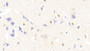 DAB staining on IHC-P; Samples: Human Cerebrum Tissue; Primary Ab: 20ug/ml Mouse Anti-Human S100B Antibody Second Ab: 2ug/mL HRP-Linked Caprine Anti-Mouse IgG Polyclonal Antibody