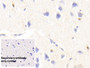 DAB staining on IHC-P; Sample: Human Cerebrum Tissue; Primary Ab: 20ug/ml Mouse Anti-Human S100B Antibody; Control: Used PBS instead of primary antibody; Second Ab: 2ug/ml HRP-Linked Caprine Anti-Mouse IgG Polyclonal Antibody
