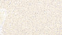 DAB staining on IHC-P; Sample: Human Liver Tissue; Primary Ab: 20ug/ml Mouse Anti-Human LRP6 Antibody; Second Ab: 2ug/mL HRP-Linked Caprine Anti-Mouse IgG Polyclonal Antibody