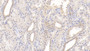 DAB staining on IHC-P; Sample: Human Kidney Tissue; Primary Ab: 20ug/ml Mouse Anti-Human SEMA3A Antibody Second Ab: 2ug/mL HRP-Linked Caprine Anti-Mouse IgG Polyclonal Antibody