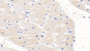 DAB staining on IHC-P; Sample: Human Cardiac Muscle Tissue; Primary Ab: 20ug/ml Mouse Anti-Human SEMA3A Antibody; Second Ab: 2ug/mL HRP-Linked Caprine Anti-Mouse IgG Polyclonal Antibody