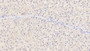 DAB staining on IHC-P; Sample: Human Liver Tissue; Primary Ab: 20ug/ml Mouse Anti-Human SEMA3A Antibody; Second Ab: 2ug/mL HRP-Linked Caprine Anti-Mouse IgG Polyclonal Antibody