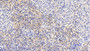 DAB staining on IHC-P; Sample: Human Spleen Tissue; Primary Ab: 20ug/ml Mouse Anti-Human SQSTM1 Antibody Second Ab: 2ug/mL HRP-Linked Caprine Anti-Mouse IgG Polyclonal Antibody