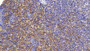 DAB staining on IHC-P; Sample: Human Lymph node Tissue; Primary Ab: 20ug/ml Mouse Anti-Human SQSTM1 Antibody; Second Ab: 2ug/mL HRP-Linked Caprine Anti-Mouse IgG Polyclonal Antibody