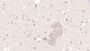 DAB staining on IHC-P; Sample: Human Cerebrum Tissue; Primary Ab: 20ug/ml Mouse Anti-Human MANF Antibody Second Ab: 2ug/mL HRP-Linked Caprine Anti-Mouse IgG Polyclonal Antibody