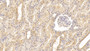DAB staining on IHC-P; Sample: Human Kidney Tissue; Primary Ab: 30ug/ml Mouse Anti-Human EGF Antibody; Second Ab: 2ug/mL HRP-Linked Caprine Anti-Mouse IgG Polyclonal Antibody