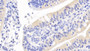 DAB staining on IHC-P; Sample: Human Small intestine Tissue; Primary Ab: 20ug/ml Mouse Anti-Human INHbA Antibody Second Ab: 2ug/mL HRP-Linked Caprine Anti-Mouse IgG Polyclonal Antibody