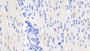 DAB staining on IHC-P; Sample: Human Cardiac Muscle Tissue; Primary Ab: 20ug/ml Mouse Anti-Human NT-ProBNP Antibody Second Ab: 2ug/mL HRP-Linked Caprine Anti-Mouse IgG Polyclonal Antibody