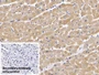 DAB staining on IHC-P; Sample: Human Cardiac Muscle Tissue; Primary Ab: 10ug/ml Mouse Anti-Human ACTC1 Antibody; Second Ab: 2ug/mL HRP-Linked Caprine Anti-Mouse IgG Polyclonal Antibody