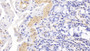 DAB staining on IHC-P; Sample: Human Small intestine Tissue; Primary Ab: 20ug/ml Mouse Anti-Human ACTC1 Antibody Second Ab: 2ug/mL HRP-Linked Caprine Anti-Mouse IgG Polyclonal Antibody