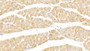 DAB staining on IHC-P; Sample: Human Cardiac Muscle Tissue; Primary Ab: 20ug/ml Mouse Anti-Human ACTC1 Antibody; Second Ab: 2ug/mL HRP-Linked Caprine Anti-Mouse IgG Polyclonal Antibody