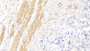 DAB staining on IHC-P; Sample: Human Stomach Tissue; Primary Ab: 20ug/ml Mouse Anti-Human ACTC1 Antibody; Second Ab: 2ug/mL HRP-Linked Caprine Anti-Mouse IgG Polyclonal Antibody