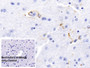 DAB staining on IHC-P; Sample: Mouse Cerebrum Tissue; Primary Ab: 20ug/ml Mouse Anti-Mouse GFAP Antibody; Control: Used PBS instead of primary antibody; Second Ab: 2ug/ml HRP-Linked Caprine Anti-Mouse IgG Polyclonal Antibody