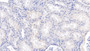 DAB staining on IHC-P; Sample: Human Kidney Tissue; Primary Ab: 10ug/ml Mouse Anti-Human DBP Antibody Second Ab: 2ug/mL HRP-Linked Caprine Anti-Mouse IgG Polyclonal Antibody