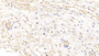 DAB staining on IHC-P; Samples: Human Placenta Tissue; Primary Ab: 10ug/ml Mouse Anti-Human GPC3 Antibody; Second Ab: 2ug/mL HRP-Linked Caprine Anti-Mouse IgG Polyclonal Antibody