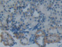 DAB staining on IHC-P; Sample: Rat Kidney Tissue; Primary Ab: 30ug/ml Mouse Anti-Rat PAI2 Antibody; Second Ab: 2ug/mL HRP-Linked Caprine Anti-Mouse IgG Polyclonal Antibody