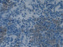 DAB staining on IHC-P; Sample: Rat Spleen Tissue; Primary Ab: 30ug/ml Mouse Anti-Rat PAI2 Antibody Second Ab: 2ug/mL HRP-Linked Caprine Anti-Mouse IgG Polyclonal Antibody