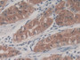 DAB staining on IHC-P; Sample: Human Stomach Tissue; Primary Ab: 20ug/ml Mouse Anti-Human LCN2 Antibody; Second Ab: 2ug/mL HRP-Linked Caprine Anti-Mouse IgG Polyclonal Antibody