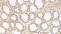 DAB staining on IHC-P; Sample: Human Colon Tissue; Primary Ab: 30ug/ml Mouse Anti-Human IL17 Antibody; Second Ab: 2ug/mL HRP-Linked Caprine Anti-Mouse IgG Polyclonal Antibody