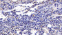 DAB staining on IHC-P; Sample: Human Small intestine Tissue; Primary Ab: 40ug/ml Mouse Anti-Human IL17 Antibody Second Ab: 2ug/mL HRP-Linked Caprine Anti-Mouse IgG Polyclonal Antibody