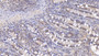 DAB staining on IHC-P; Sample: Human Small intestine Tissue; Primary Ab: 20ug/ml Mouse Anti-Human IL17 Antibody Second Ab: 2ug/mL HRP-Linked Caprine Anti-Mouse IgG Polyclonal Antibody