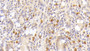 DAB staining on IHC-P; Sample: Human Small intestine Tissue; Primary Ab: 20ug/ml Mouse Anti-Human LIF Antibody Second Ab: 2ug/mL HRP-Linked Caprine Anti-Mouse IgG Polyclonal Antibody