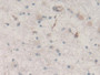 DAB staining on IHC-P; Sample: Human Glioma Tissue; Primary Ab: 30ug/ml Mouse Anti-Human NES Antibody; Second Ab: 2ug/mL HRP-Linked Caprine Anti-Mouse IgG Polyclonal Antibody