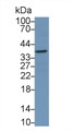 Western Blot; Sample: Rat Kidney lysate Primary Ab: 2ug/ml Mouse Anti-Human SDC1 Antibody Second Ab: 0.2ug/mL HRP-Linked Caprine Anti-Mouse IgG Polyclonal Antibody