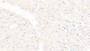 DAB staining on IHC-P; Sample: Human Cardiac Muscle Tissue; Primary Ab: 10ug/ml Mouse Anti-Human BECN1 Antibody; Second Ab: 2ug/mL HRP-Linked Caprine Anti-Mouse IgG Polyclonal Antibody