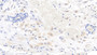 DAB staining on IHC-P; Samples: Human Placenta Tissue; Primary Ab: 10ug/ml Mouse Anti-Human WNT3A Antibody Second Ab: 2ug/mL HRP-Linked Caprine Anti-Mouse IgG Polyclonal Antibody