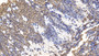 DAB staining on IHC-P; Sample: Human Small intestine Tissue; Primary Ab: 10ug/ml Mouse Anti-Human WNT3A Antibody; Second Ab: 2ug/mL HRP-Linked Caprine Anti-Mouse IgG Polyclonal Antibody