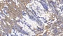 DAB staining on IHC-P; Sample: Human Small intestine Tissue; Primary Ab: 10ug/ml Mouse Anti-Human WNT3A Antibody; Second Ab: 2ug/mL HRP-Linked Caprine Anti-Mouse IgG Polyclonal Antibody