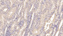 DAB staining on IHC-P; Sample: Human Kidney Tissue; Primary Ab: 20ug/ml Mouse Anti-Human IFNa21 Antibody Second Ab: 2ug/mL HRP-Linked Caprine Anti-Mouse IgG Polyclonal Antibody