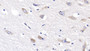 DAB staining on IHC-P; Sample: Human Cerebrum Tissue; Primary Ab: 40ug/ml Mouse Anti-Human RELN Antibody Second Ab: 2ug/mL HRP-Linked Caprine Anti-Mouse IgG Polyclonal Antibody