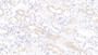 DAB staining on IHC-P; Sample: Human Kidney Tissue; Primary Ab: 20ug/ml Mouse Anti-Human IL9 Antibody Second Ab: 2ug/mL HRP-Linked Caprine Anti-Mouse IgG Polyclonal Antibody