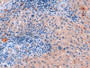 DAB staining on IHC-P; Sample: Human Liver Tissue; Primary Ab: 20ug/ml Mouse Anti-Human FGF21 Antibody; Second Ab: 2ug/mL HRP-Linked Caprine Anti-Mouse IgG Polyclonal Antibody