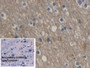 DAB staining on IHC-P; Sample: Human Cerebrum Tissue; Primary Ab: 20ug/ml Mouse Anti-Human AQP4 Antibody; Control: Used PBS instead of primary antibody; Second Ab: 2ug/ml HRP-Linked Caprine Anti-Mouse IgG Polyclonal Antibody