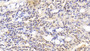 DAB staining on IHC-P; Sample: Human Small intestine Tissue; Primary Ab: 20ug/ml Mouse Anti-Human CNX Antibody Second Ab: 2ug/mL HRP-Linked Caprine Anti-Mouse IgG Polyclonal Antibody