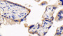 DAB staining on IHC-P; Sample: Human Placenta Tissue; Primary Ab: 30ug/ml Mouse Anti-Human CD147 Antibody Second Ab: 2ug/mL HRP-Linked Caprine Anti-Mouse IgG Polyclonal Antibody