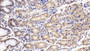 DAB staining on IHC-P; Sample: Human Stomach Tissue; Primary Ab: 30ug/ml Mouse Anti-Human CD147 Antibody; Second Ab: 2ug/mL HRP-Linked Caprine Anti-Mouse IgG Polyclonal Antibody