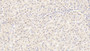 DAB staining on IHC-P; Sample: Human Liver Tissue; Primary Ab: 20ug/ml Mouse Anti-Human WNT11 Antibody Second Ab: 2ug/mL HRP-Linked Caprine Anti-Mouse IgG Polyclonal Antibody