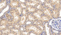 DAB staining on IHC-P; Sample: Human Kidney Tissue; Primary Ab: 20ug/ml Mouse Anti-Human IBA1 Antibody; Second Ab: 2ug/mL HRP-Linked Caprine Anti-Mouse IgG Polyclonal Antibody