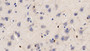 DAB staining on IHC-P; Sample: Human Cerebrum Tissue; Primary Ab: 20ug/ml Mouse Anti-Human IBA1 Antibody; Second Ab: 2ug/mL HRP-Linked Caprine Anti-Mouse IgG Polyclonal Antibody
