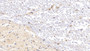 DAB staining on IHC-P; Sample: Human Spinal cord Tissue; Primary Ab: 20ug/ml Mouse Anti-Human IBA1 Antibody; Second Ab: 2ug/mL HRP-Linked Caprine Anti-Mouse IgG Polyclonal Antibody
