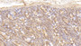 DAB staining on IHC-P; Sample: Human Small intestine Tissue; Primary Ab: 30ug/ml Mouse Anti-Human DAF Antibody Second Ab: 2ug/mL HRP-Linked Caprine Anti-Mouse IgG Polyclonal Antibody